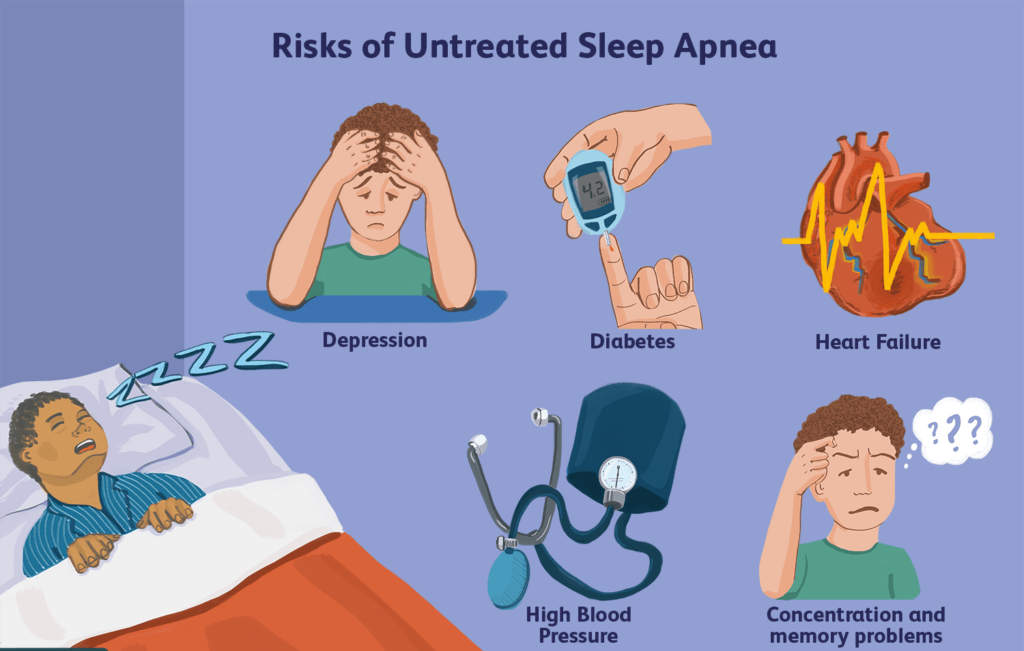 sleep-apnea